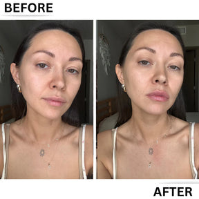 Lip Enhancer