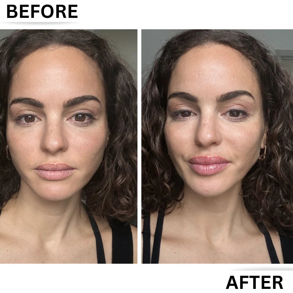 Lip Enhancer