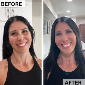 PlasmaGLO™ LED HALO Hair, Face and Neck Mask