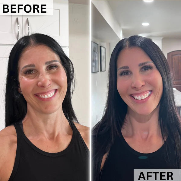 PlasmaGLO™ LED HALO Hair, Face and Neck Mask