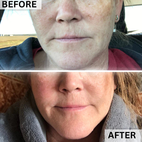 PlasmaGLO™ LED HALO Hair, Face and Neck Mask